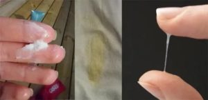 После поименения утрожестана утром вытекла липкая водичка