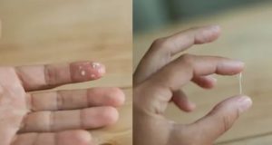 После поименения утрожестана утром вытекла липкая водичка