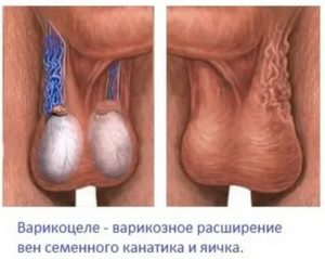 Проблема с коже мошонки