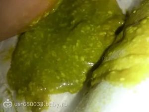 Не проходит еда - рвота со слизью
