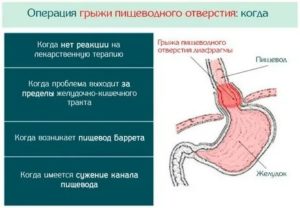 ГПОД и роды