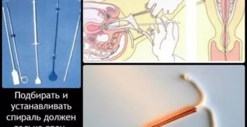 Задержка при Вмс