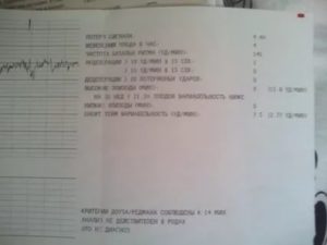 Помогите расшифровать КТГ на 36 неделе