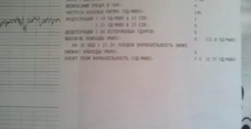 Помогите расшифровать КТГ на 36 неделе