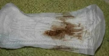 Коричневые выделения после секса