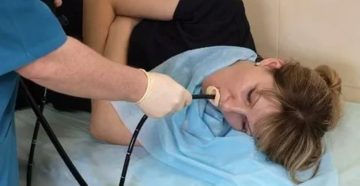 Неприятные ощущения после гастроскопии Неприятные ощущения после гастроскопии