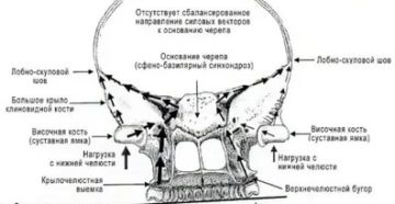 Боль в кости черепа