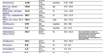 Расшифровка анализа крови, повышены лимфоциты