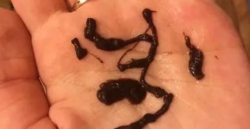 Коричневые сгустки во время месячных
