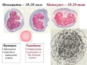 Моноциты 18%