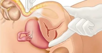 Можно ли через задний проход узнать беременность