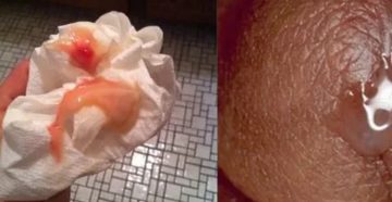 Месячные идут дольше обычного