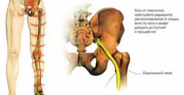 Боли ягодице и ноге после уколов спазган