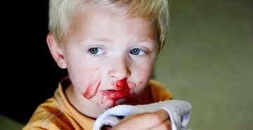 Частые кровотечения из носа у ребенка Частые кровотечения из носа у ребенка