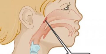 Не дышит ноздря Не дышит ноздря