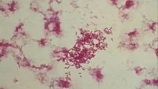 Что могло вызвать появление кишечной палочки morganella morganii?