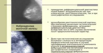 Фиброаденома или рак