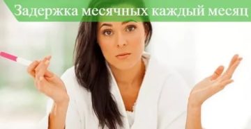 Задержка каждый месяц