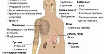 Ломота в теле, без температуры