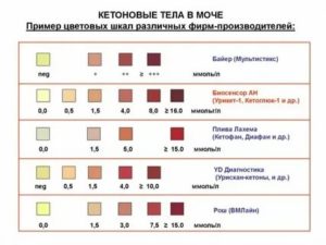 Кетоны в моче 20 мг/дл