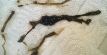 Мазня и боли как при ПМС в середине цикла (Джес)