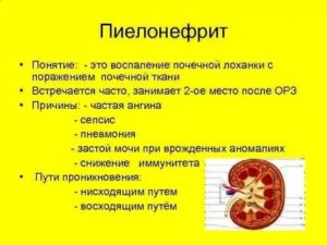 Воспаление хронического пиелоцистита