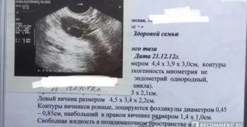УЗИ, маленькие фолликулы в середине цикла