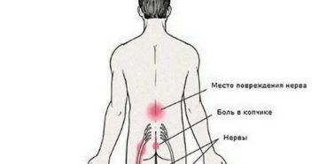 ЖЖение в области копчика