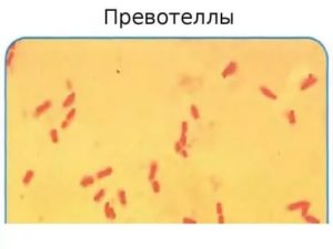 Prevotella spp