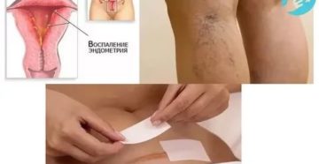 Болят половые губы после ПА во время беременности