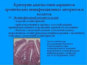 Хронический энтерит у ребенка