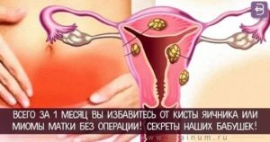 Последствия ошибки принятия регивидона для избавления от фолликулярной кисты
