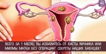 Последствия ошибки принятия регивидона для избавления от фолликулярной кисты