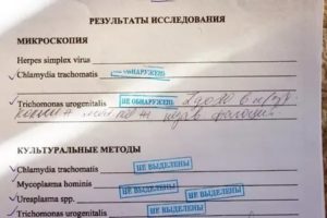 Пцр на трихомониаз
