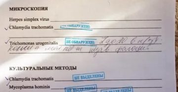 Пцр на трихомониаз