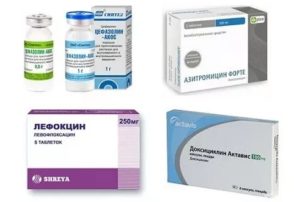 Необходимость антибиотиков при кашле без температуры