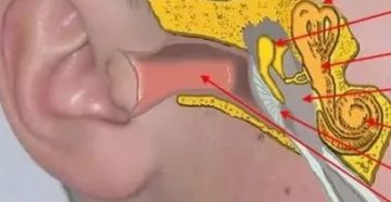 Насморк, заложило оба уха, болит горло Насморк, заложило оба уха, болит горло