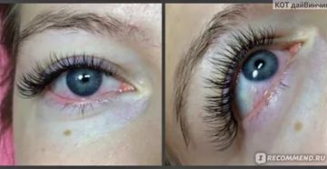 Покраснение глаза после наращивания ресниц
