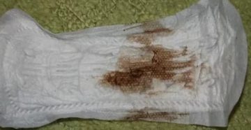 Кровянистые выделения по утрам вместо месячных