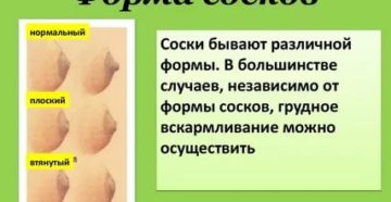 Неправильная форма сосков