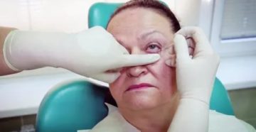 Массаж при халязионе