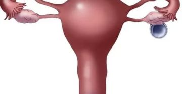 Боли при фолликулярной кисте