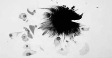 В глазу чёрная маленькая клякса