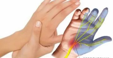 Не работает левая рука