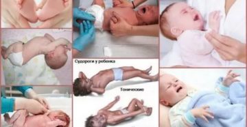 Судороги или тремор после сна у ребенка