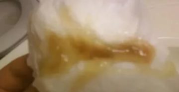 Коричневая слизь при беременности