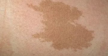 Пятно коричневого цвета