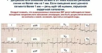 Выраженные изменения миокарда при беременности