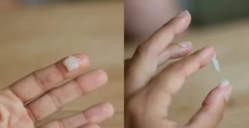 Клайра и обильные выделения