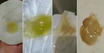 Густое желтое молоко или гной